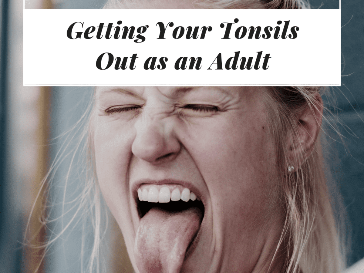 Tonsillectomy Recovery For Adults Day By Day Patient S Lounge