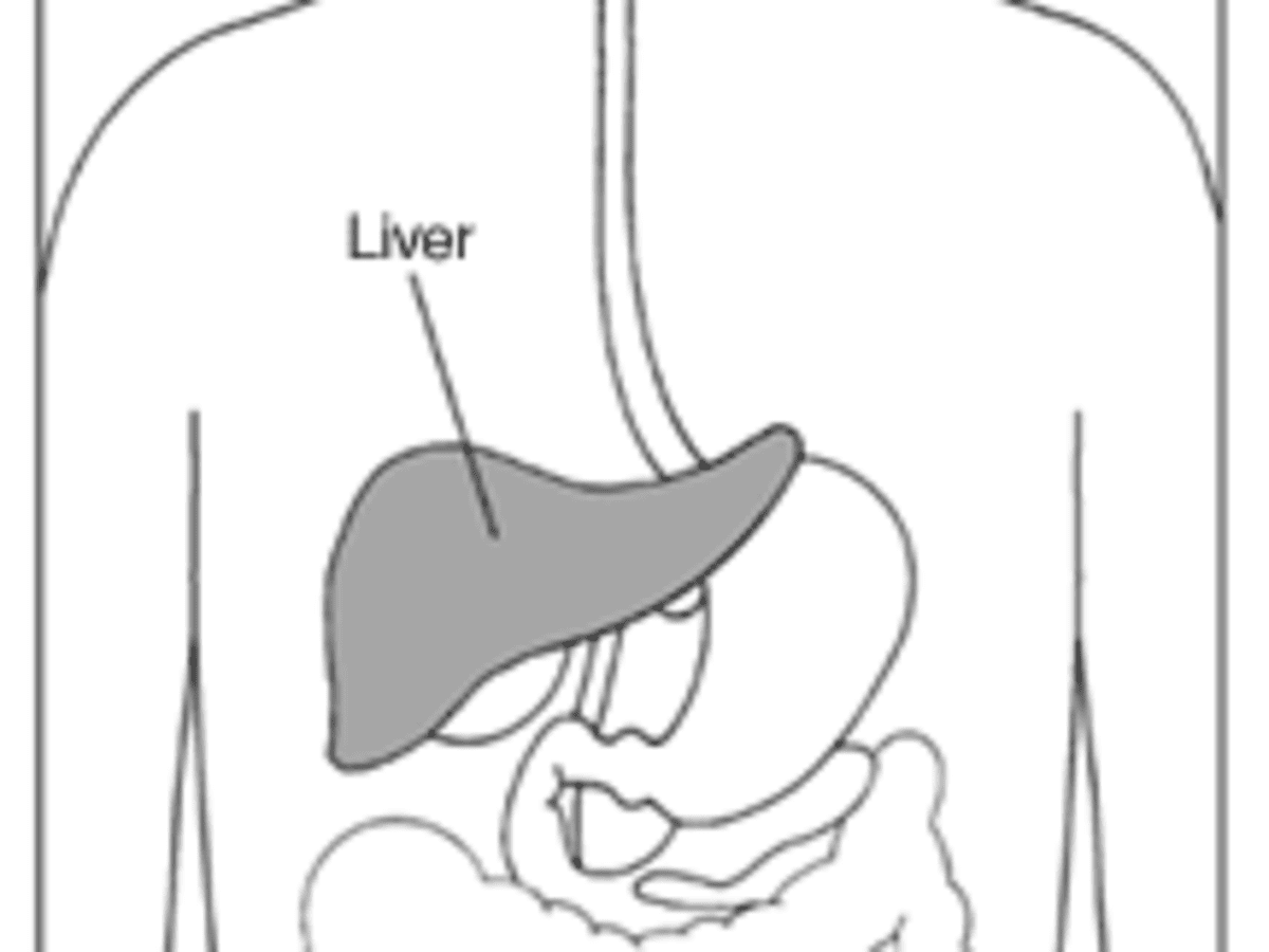 The world's first case of liver cirrhosis in a child with Castleman's  disease
