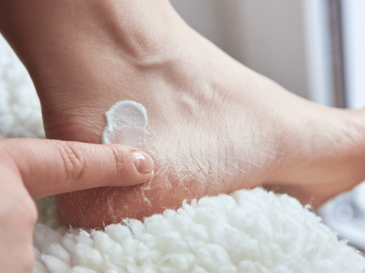 Premium Photo | Cracked heel treatment the foot cream should be applied  regularly. rub and massage the heels for the cream to absorb well. helps  add moisture to the skin of the