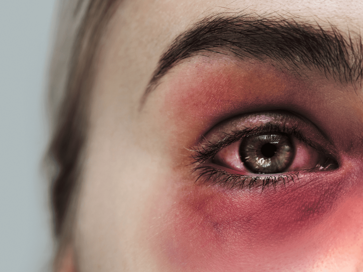 How To Er A Black Eye With Makeup