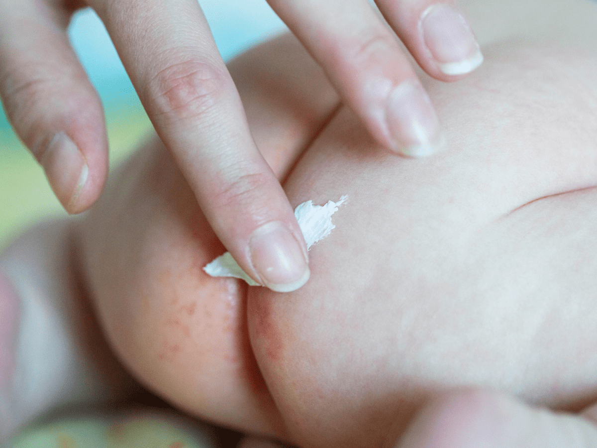 Triple Paste Diaper Rash Cream for Baby