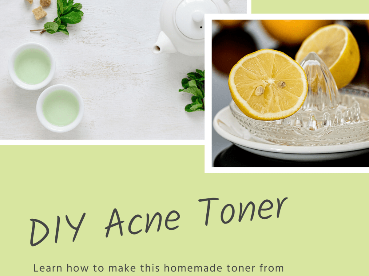 homemade toner for acne scars