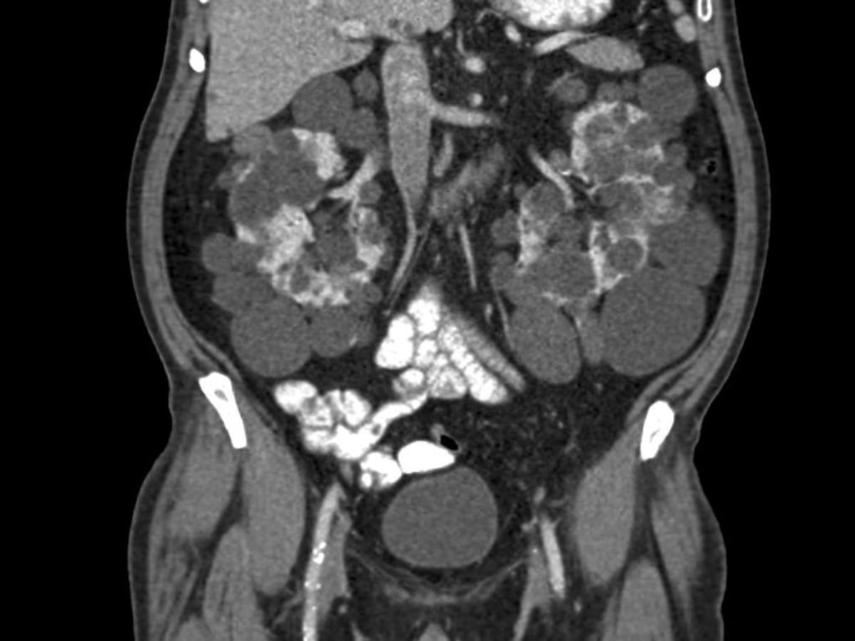 洋書 CT and MRI of the abdomen and pelvis CT and MRI of the Abdomen and Pelvis: A Teaching File (LWW