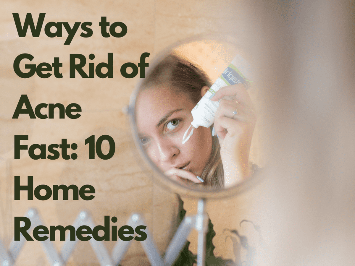 Get rid of store acne overnight