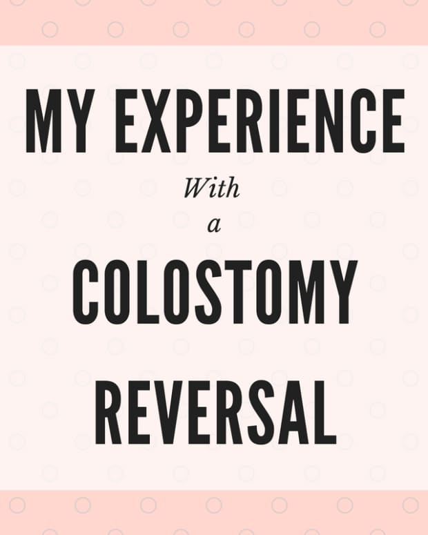 temporary-colostomy_reverse-colostomy_ostomy-reversal_stoma_reversal