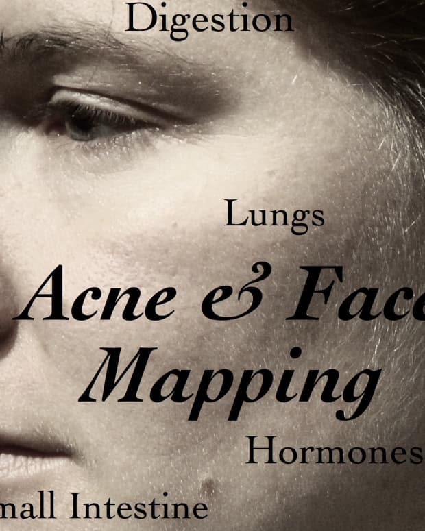 face-mapping-whats-your-acne-telling-you