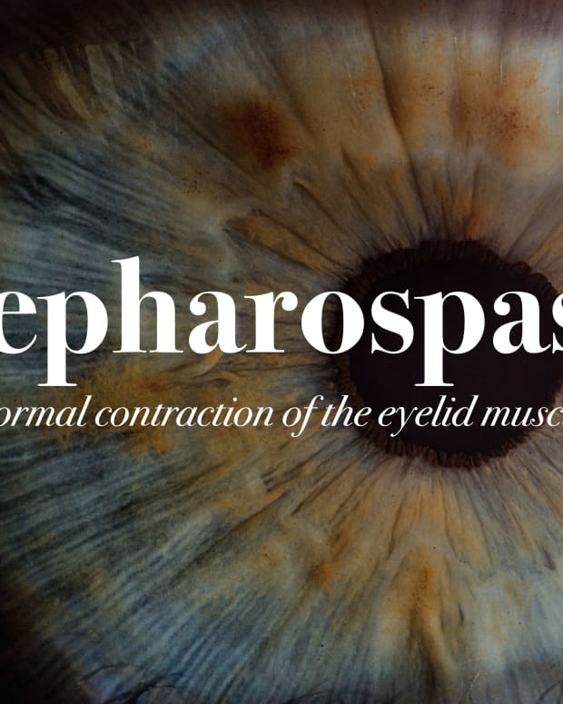 when-eyes-blink-excessively-or-squeezeit-could-be-blepharospasm