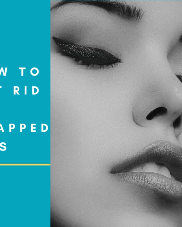 chapped-lips-how-to-get-rid-of-chapped-lips