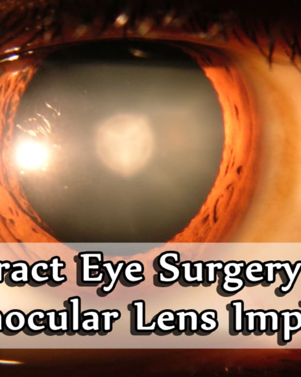 cataract-surgery-intraocular-lenses-and-more