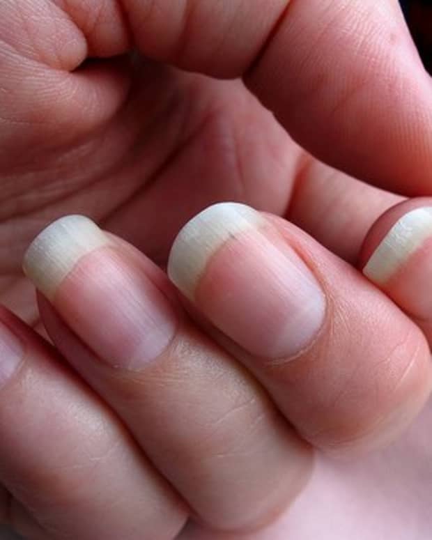 why-some-people-bite-their-nails