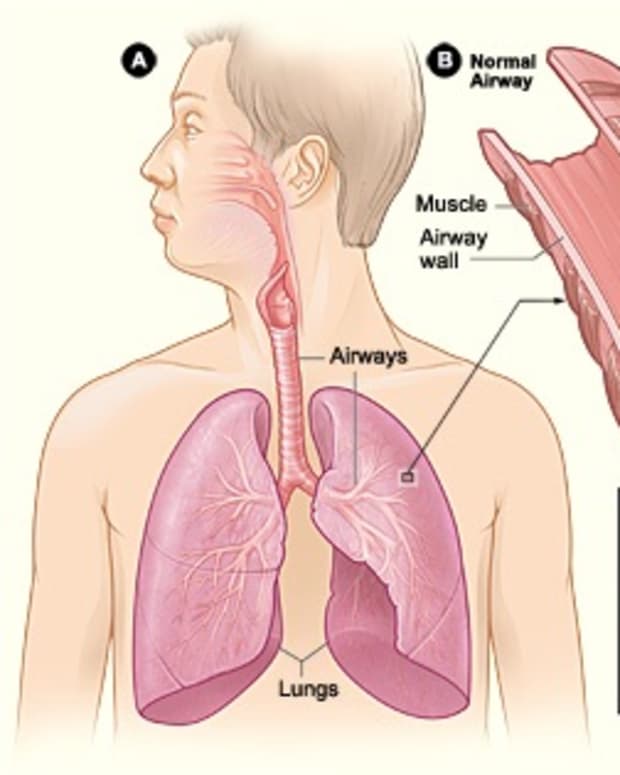 effects-of-budesonide-and-formoterol-on-asthma-and-on-the-body