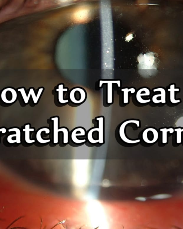 how-to-treat-a-scratched-cornea