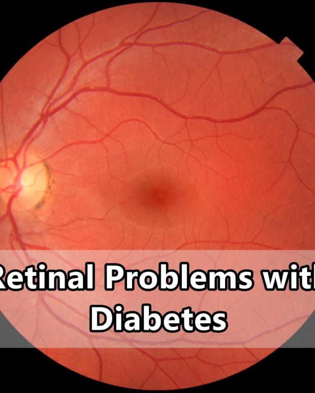 retinal-problems-with-diabetes