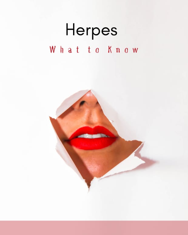 healing-herpes-naturally