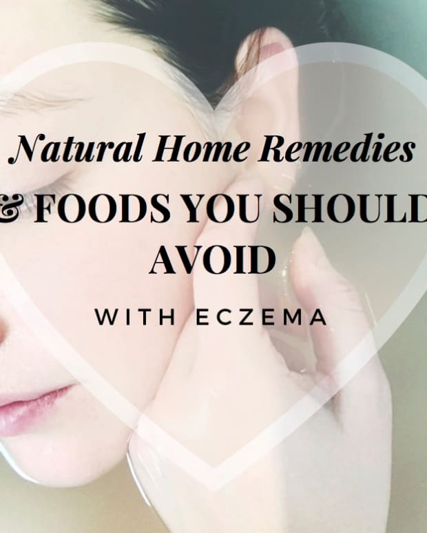suffer-with-eczema-avoid-these-6-foods