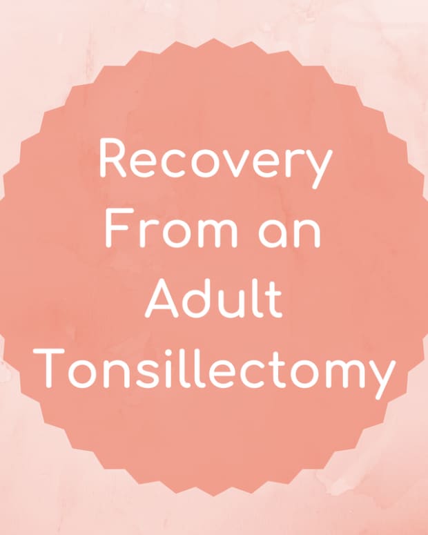tonsillectomy-for-adults