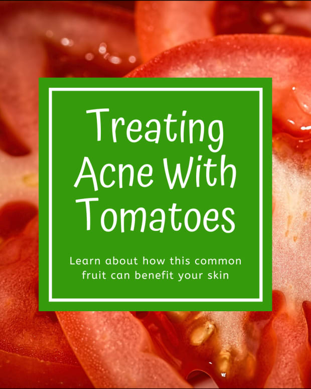 how-to-treat-acne-tomatoes