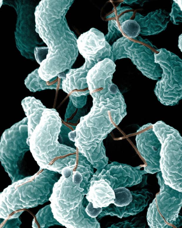 campylobacter-bacteria-gastroenteritis-and-foodborne-illness