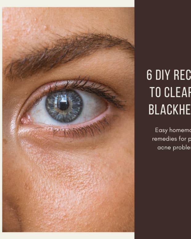 how-to-get-rid-of-blackheads-6-homemade-recipes-to-get-rid-of-blackheads
