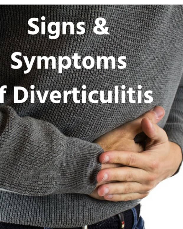 diverticulitis-signs-and-symptoms-from-my-experience