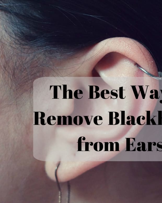 how-to-get-rid-of-blackheads-in-ears