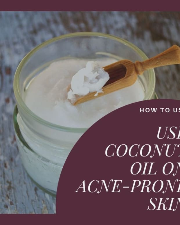 coconut-oil-acne