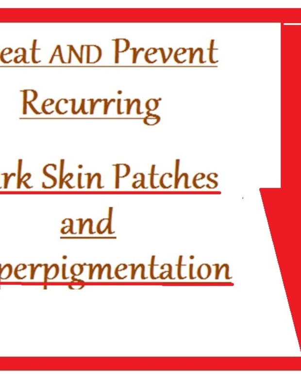 hyperpigmentation-treatmenst-and-prevention