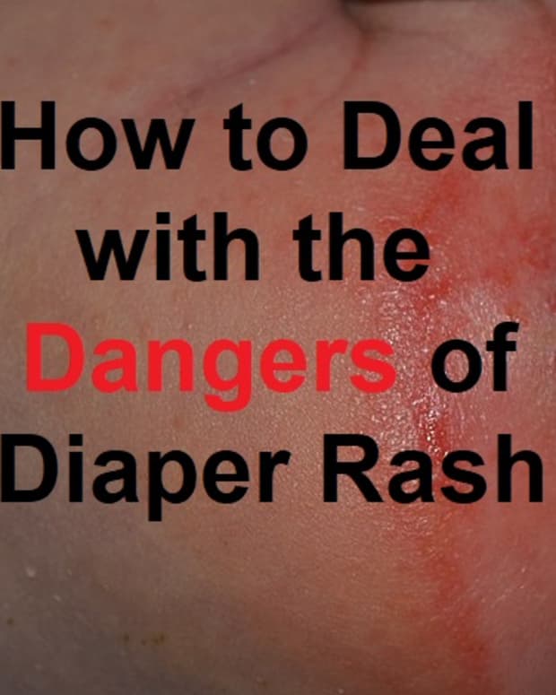 how-to-deal-with-the-dangers-of-diaper-rash