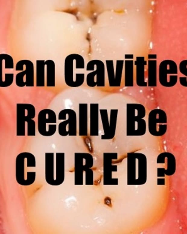 cure-cavities