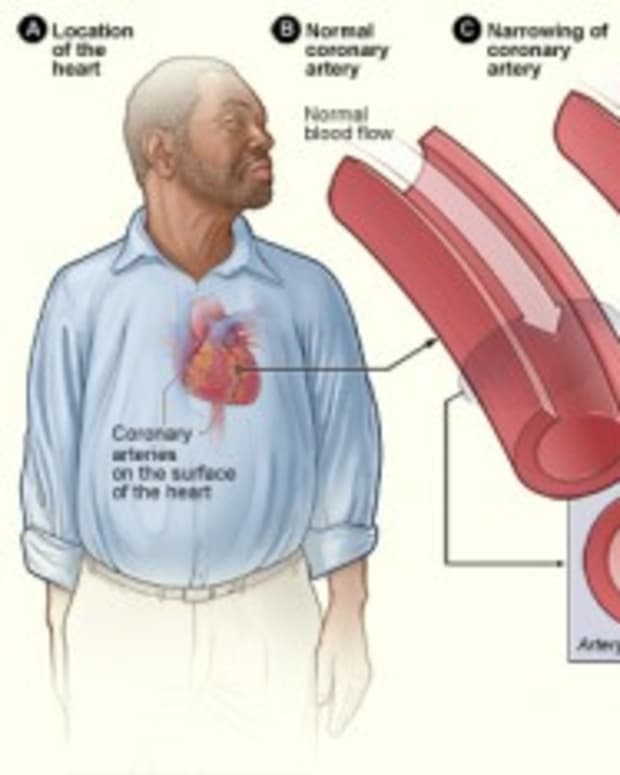 risk-factors-for-coronary-heart-disease