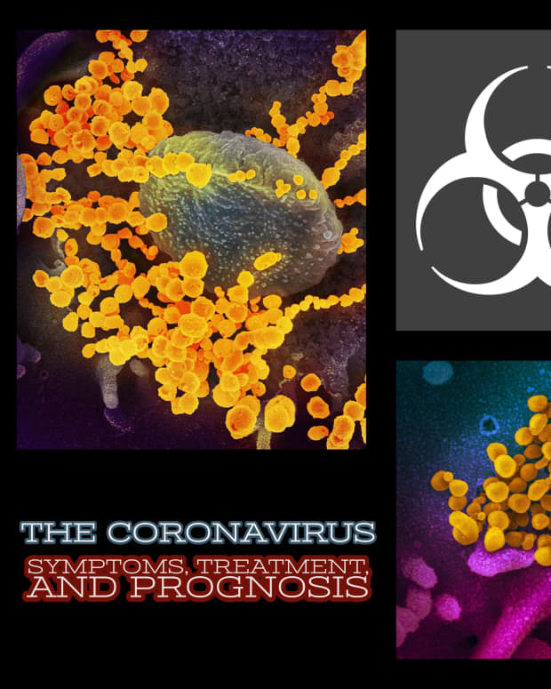 the-coronavirus-symptoms-treatment-and-prognosis