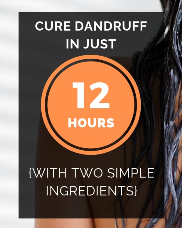 how-to-cure-scalp-eyebrow-dandruff-in-12-hours-overnight