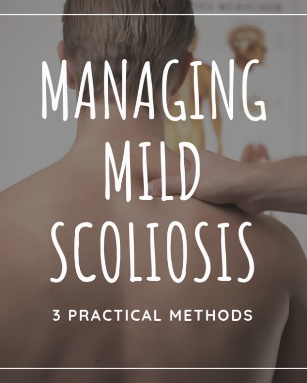 3-ways-to-treat-mild-scoliosis