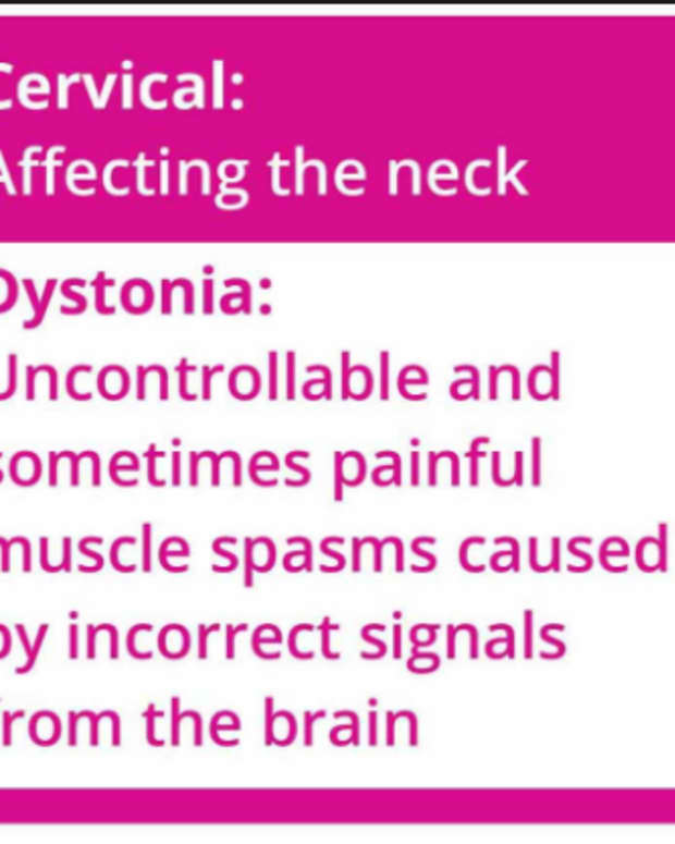 what-is-cervical-dystonia