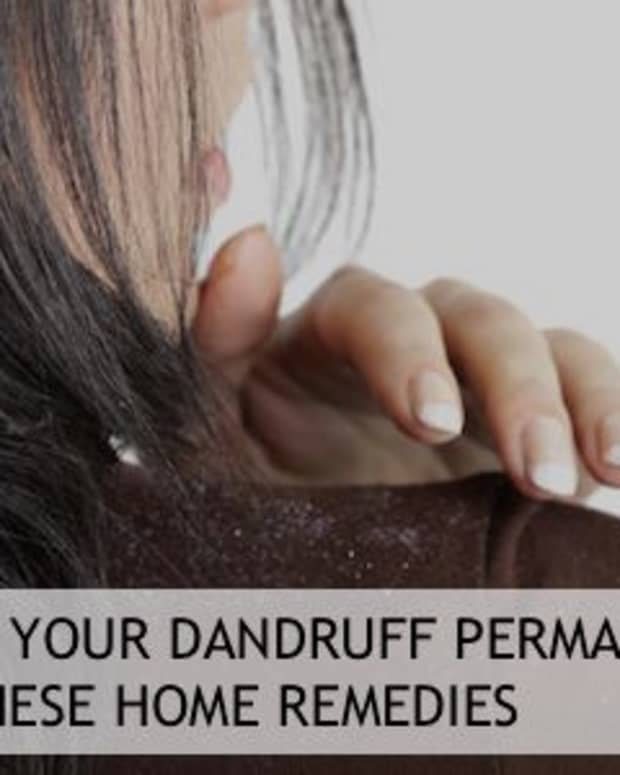 how-to-remove-dandruff-permanently