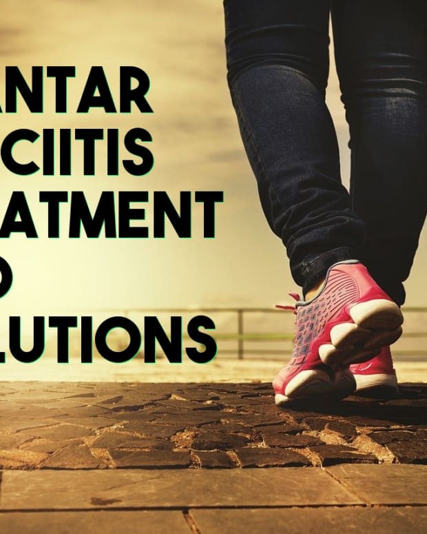 top-5-solutions-for-plantar-fasciitis-heel-pain