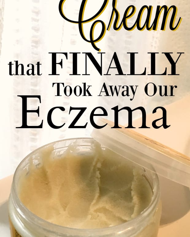 eczema-cream-that-works