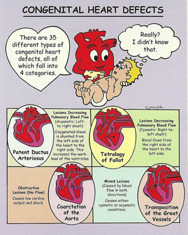your-chd-heart-baby-needs-your-support-but-so-do-you