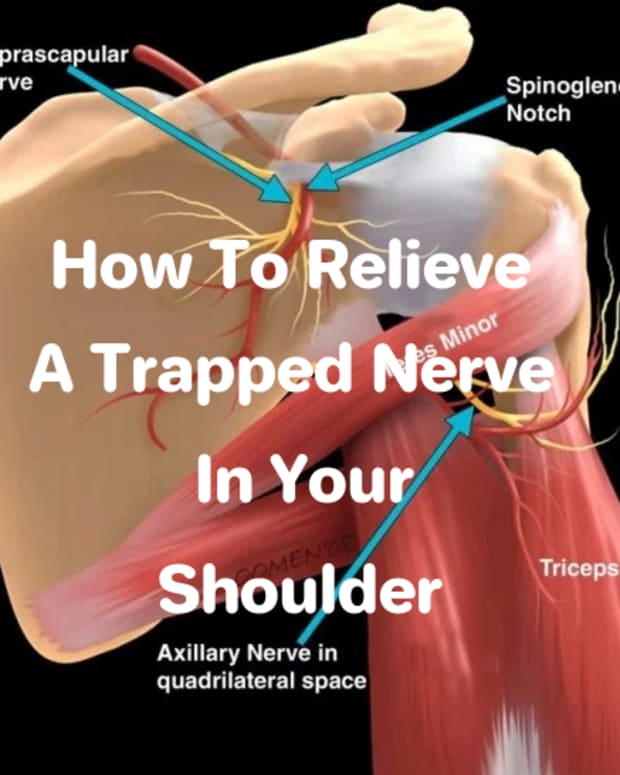 how-to-relieve-a-trapped-nerve-in-your-shoulder