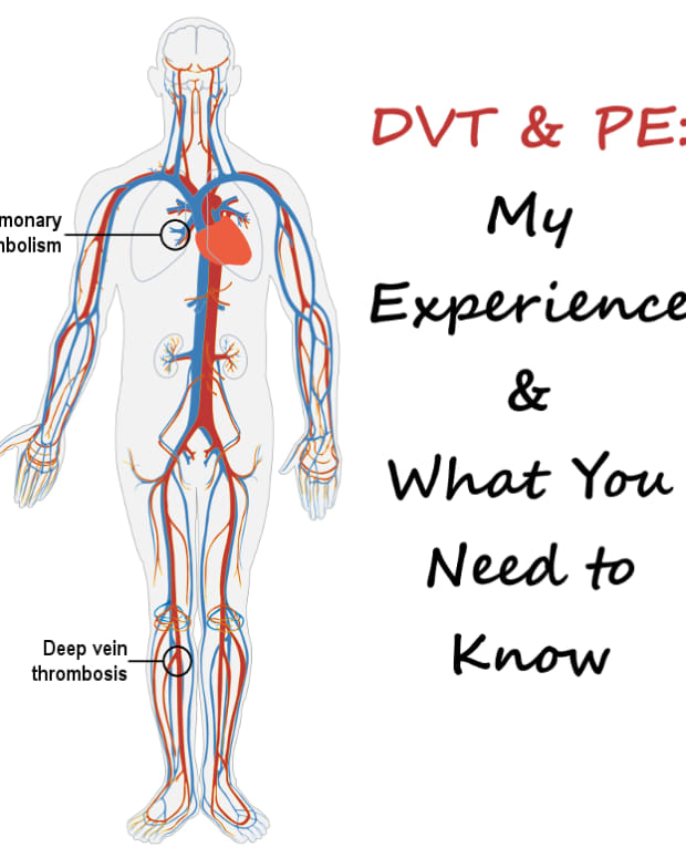 dvt-and-pe-causes-symptoms-treatment-and-prophylaxis