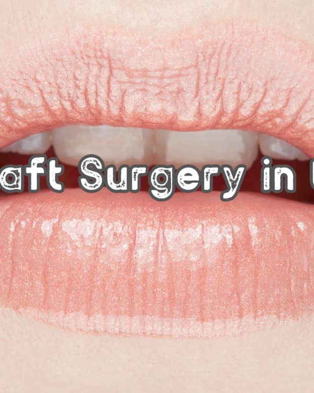 gum-graft-surgery-and-cost-uk