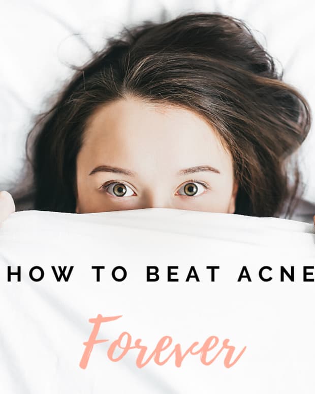 three-solutions-to-solve-your-acne-forever