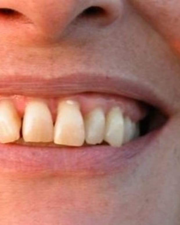 how-to-manage-gum-disease-naturally