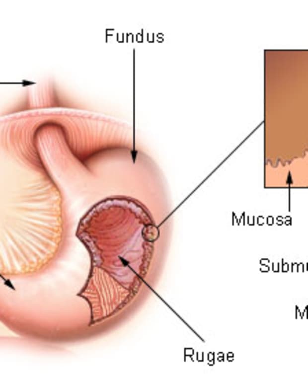 how-to-cure-gastritis