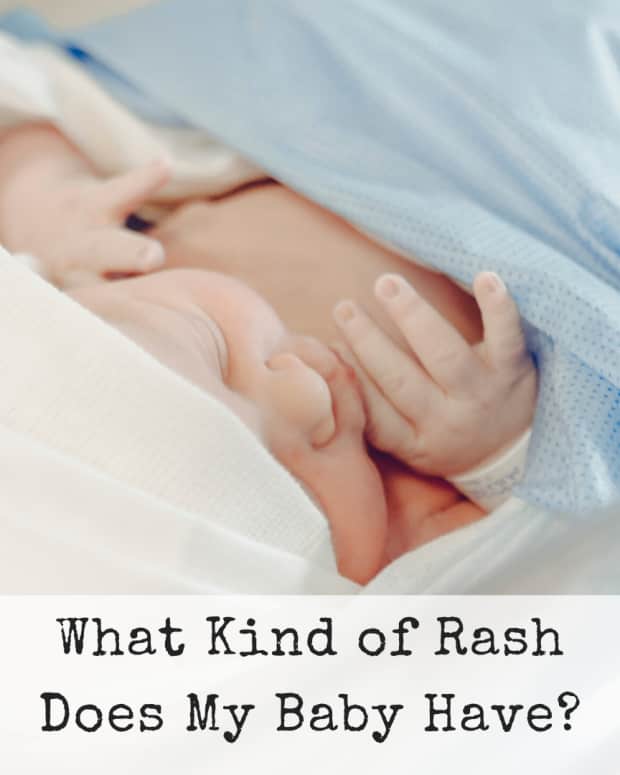 How to Get Rid of a Diaper Rash (in 24 Hours or Less) WeHaveKids