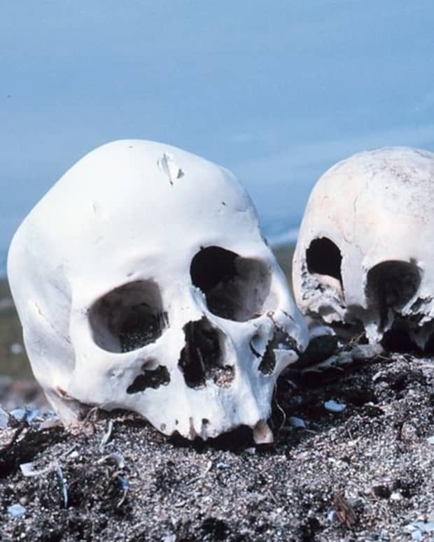 Bones can be evidence (public domain).