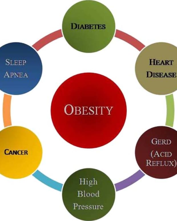international-obesity-facts-highest-vs-lowest-worldwide-obesity-rates