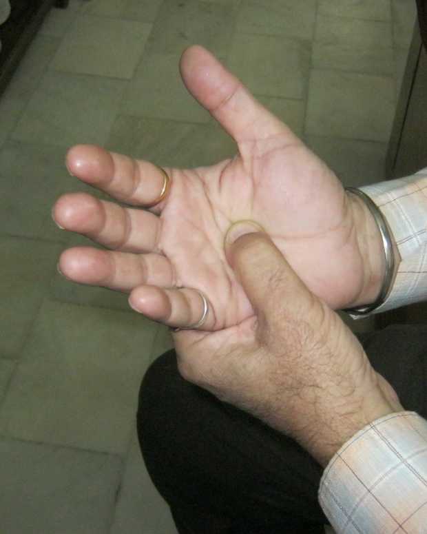insomnia-treatment-with-acupressure-therapy