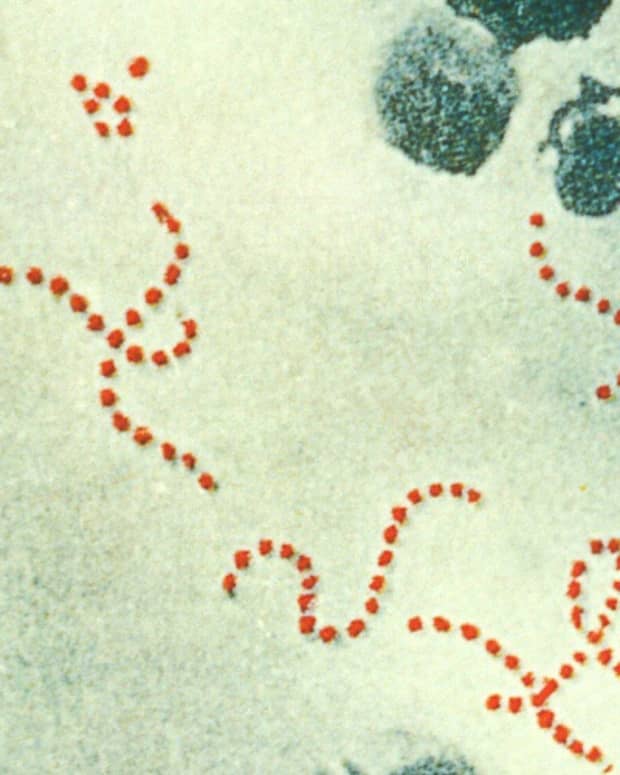streptococcus-bacterial-infections-group-a-and-group-b