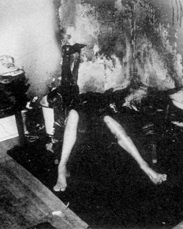 facts-about-the-notso-spontaneous-human-combustion